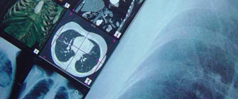 QA of CR and DR Systems